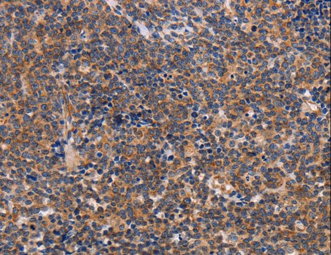 ALG9 Antibody