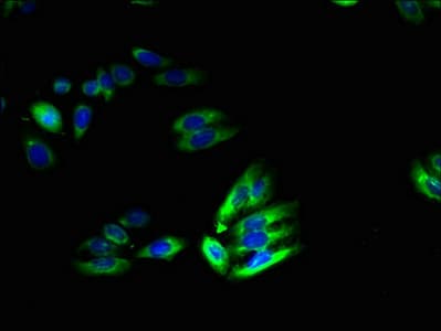 Polyclonal Rabbit anti-Human SLC46A2 Antibody (WB)