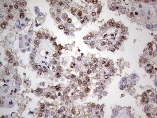 PCNA Antibody (clone OTI13G4)