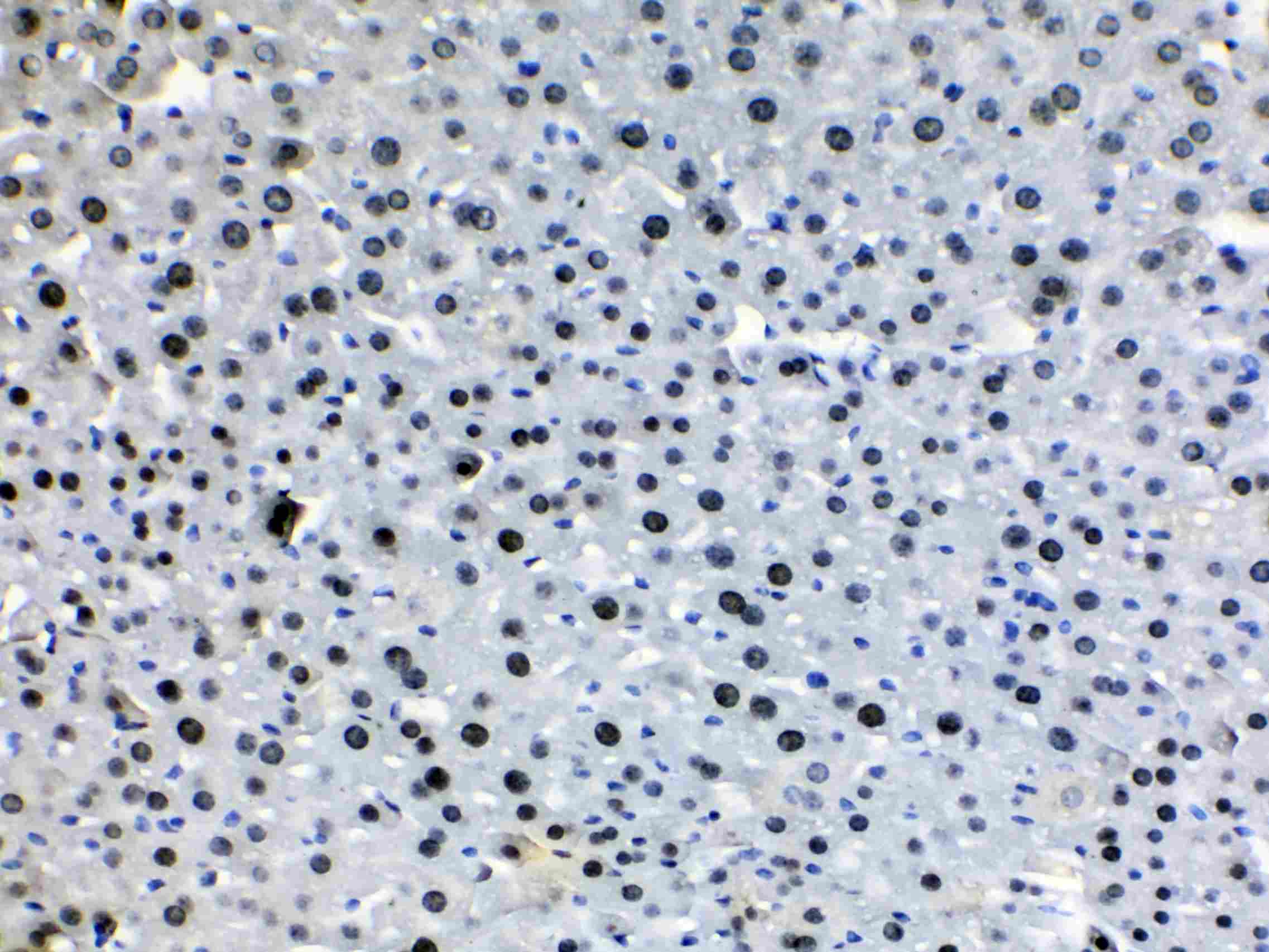 HDGF Antibody