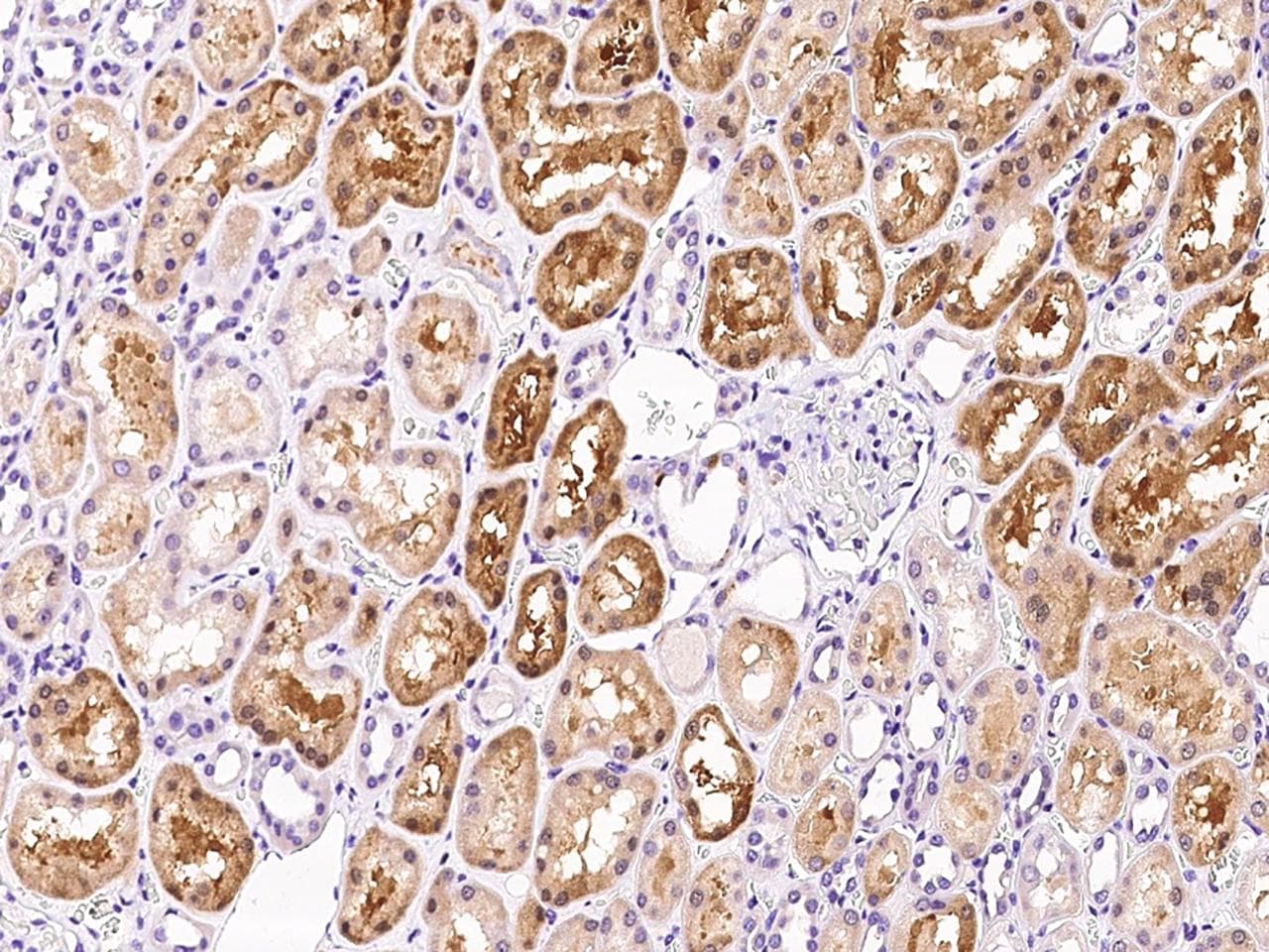 F12 / Factor XII Antibody (Preservative Free)