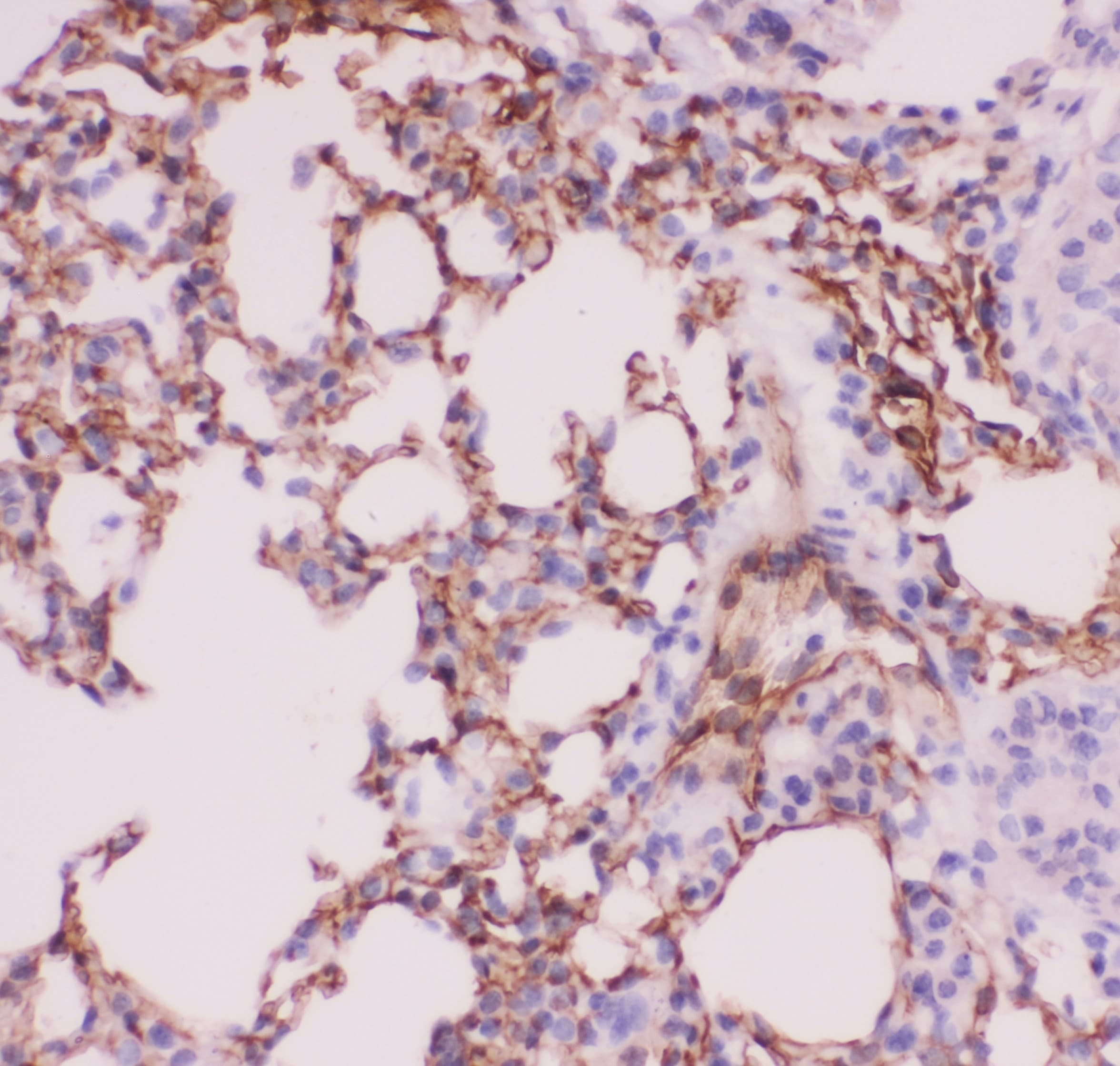 ACE / CD143 Antibody (aa651-864)