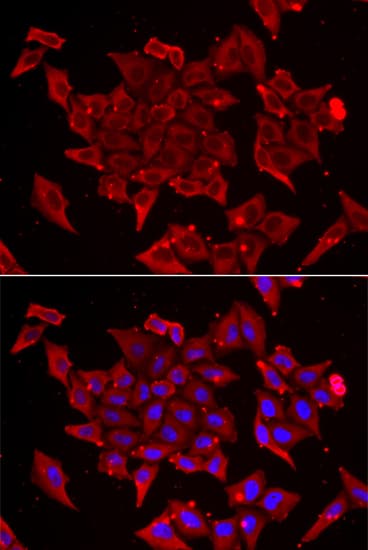 Polyclonal Rabbit anti-Human TIMM17A / TIM17 Antibody (IHC, IF, WB)