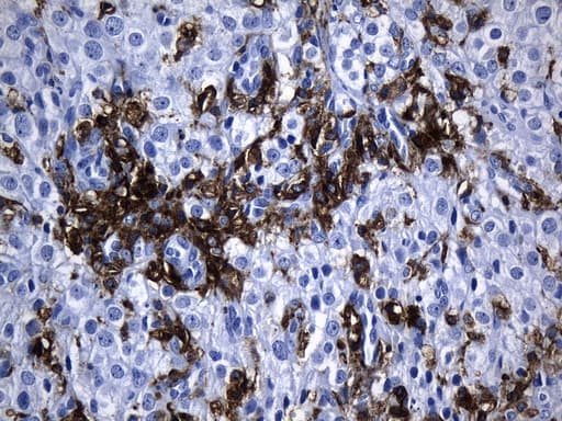 Monoclonal Mouse anti-Human MSR1 / CD204 Antibody (clone UMAB247, aa197-451, IHC)