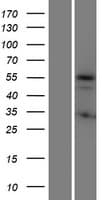 KRT72 / Keratin 72 / K6irs Protein (Over-Expression Lysate Myc-DDK (Flag))
