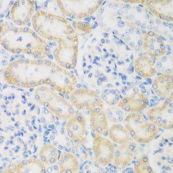 Polyclonal Rabbit anti-Human NAT8B Antibody (IHC, IF, WB)