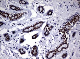 NBN / Nibrin Antibody (clone OTI2E10)