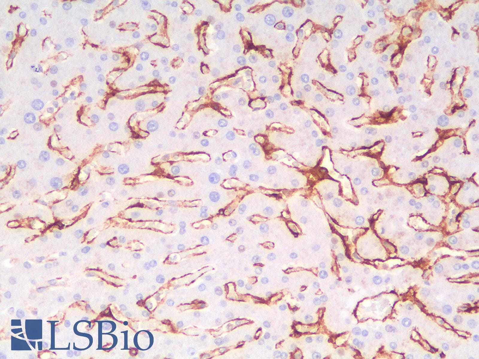 PathPlus™ THBD / CD141 / Thrombomodulin Antibody (aa 69-194, clone rTHBD/1591)