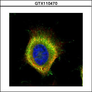 FASN / Fatty Acid Synthase Antibody (aa401-694)