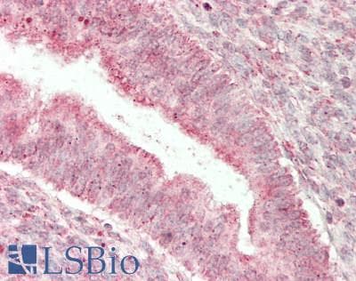 IHC-plus™ SPTLC1 / HSN1 Antibody (aa50-100)