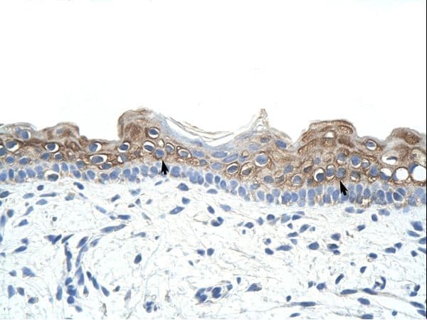 DAZ2 Antibody (aa51-100)