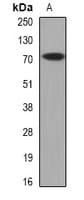 CRAT Antibody