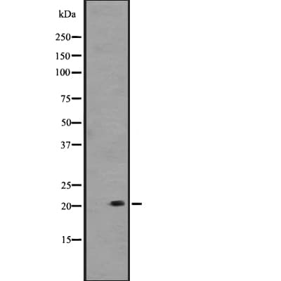 Polyclonal Rabbit anti-Human PRDX1 / Peroxiredoxin 1 Antibody (WB)