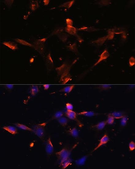 CLDN5 / Claudin 5 Antibody