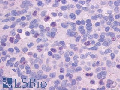 IHC-plus™ Polyclonal Rabbit anti-Human FPR1 / FPR Antibody (Extracellular Domain, IHC)