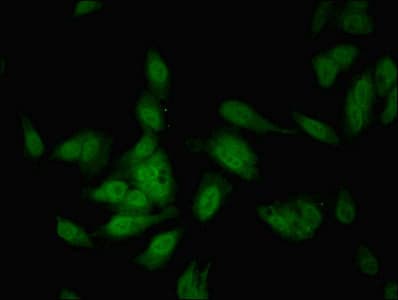 Polyclonal Rabbit anti-Human COBLL1 Antibody (IHC)