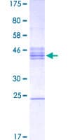 Human MATH2 / NEUROD6 Protein (Recombinant GST, N-terminus)