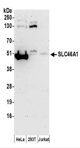 IHC-plus™ SLC46A1 / HCP1 Antibody (aa225-275)
