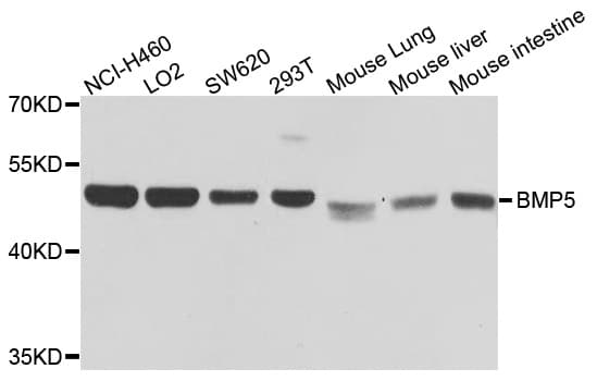 IHC-plus™ BMP5 Antibody