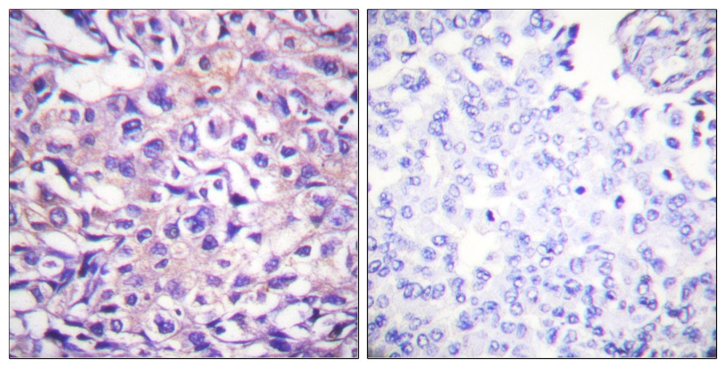 PPP1R12A / MYPT1 Antibody (phospho-Thr696)