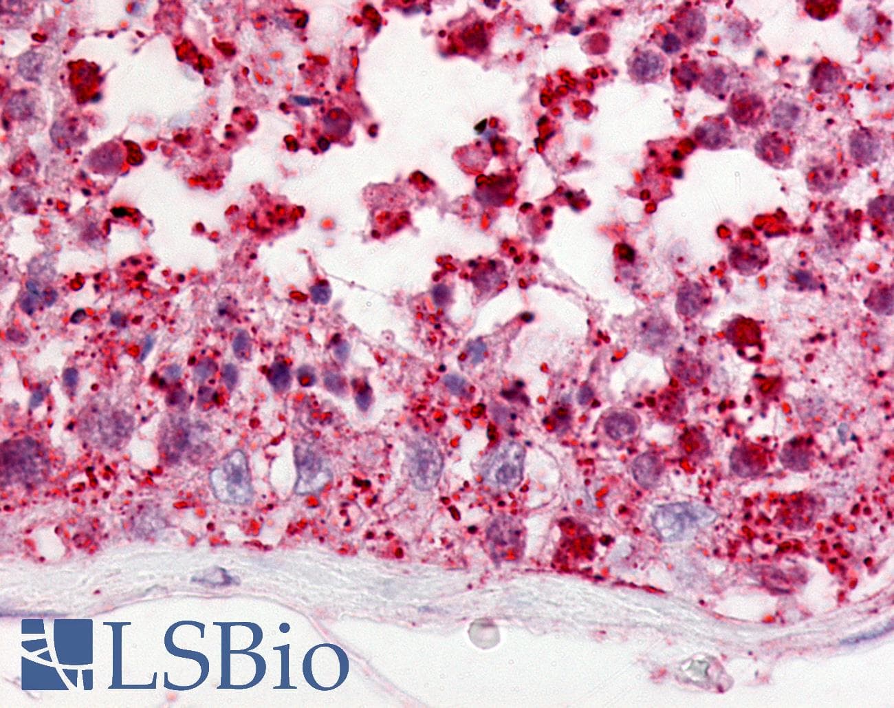 IHC-plus™ Polyclonal Rabbit anti-Human GPCRW / GPR18 Antibody (Cytoplasmic Domain, IHC)
