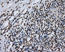 DAPK2 / DAP Kinase 2 Antibody (clone OTI1F7, Carrier-free)