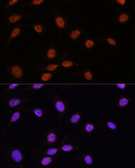 Polyclonal Rabbit anti-Human SFRS7 / 9G8 Antibody (IF)