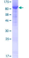 Human NGLY1 Protein (Recombinant GST)