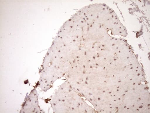 HOXC10 Antibody (aa1-262, clone OTI5C10, Carrier-free)