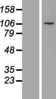 CCDC141 Protein (Over-Expression Lysate Myc-DDK (Flag))
