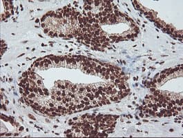EXOSC7 Antibody (clone OTI1G8)