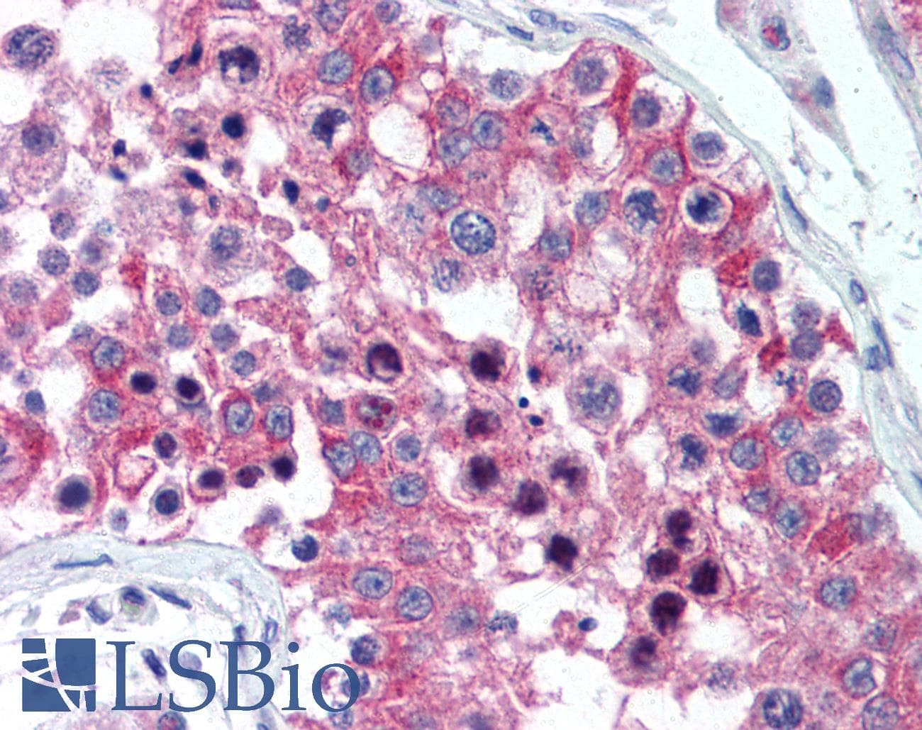 IHC-plus™ Polyclonal Rabbit anti-Human IL20RA Antibody (aa159-175, IHC, WB)