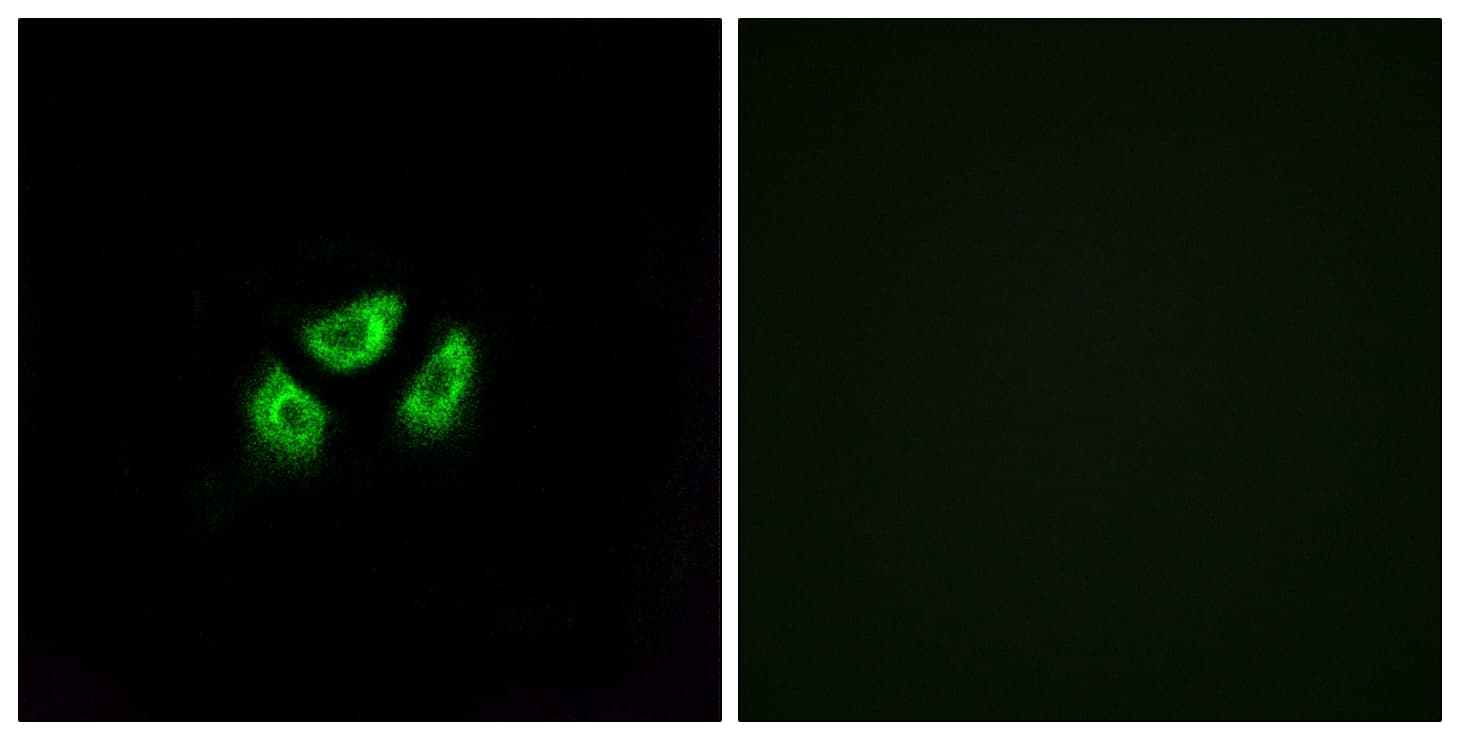 SCN7A Antibody (aa771-820)