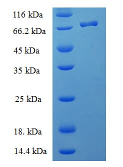 Human BAG5 Protein (Recombinant His-SUMO)