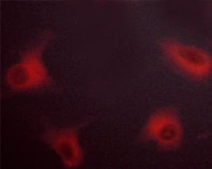 RAF1 / RAF Antibody (phospho-Ser621)