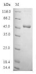 Human SSX4 Protein (Recombinant GST, N-terminus)