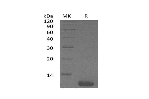 Human I-309 / CCL1 Protein (Recombinant)