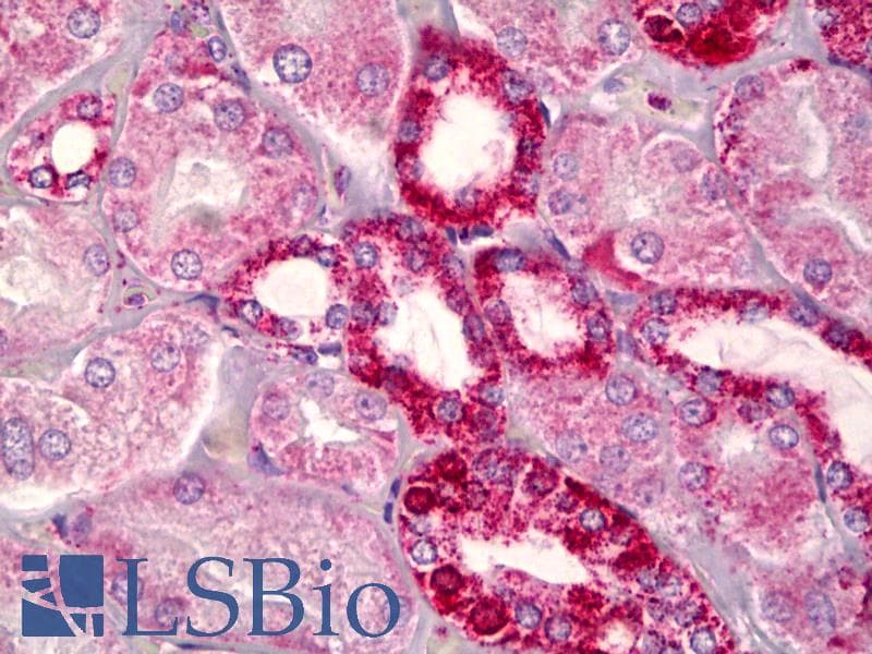 IHC-plus™ BCL2 / Bcl-2 Antibody (aa46-95)
