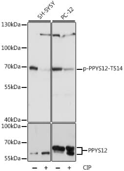 Polyclonal Rabbit anti-Human DPYSL2 / CRMP2 Antibody (phospho-Thr514, WB)