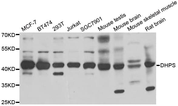 Polyclonal Rabbit anti-Human DHPS Antibody (IHC, WB)