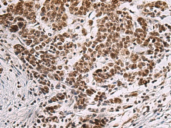 Polyclonal Rabbit anti-Human CREBBP / CREB Binding Protein Antibody (IHC)