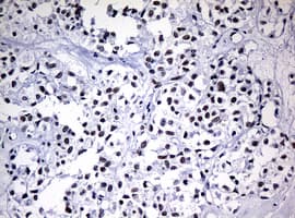 NBN / Nibrin Antibody (aa183-460, clone OTI2F5, Carrier-free)