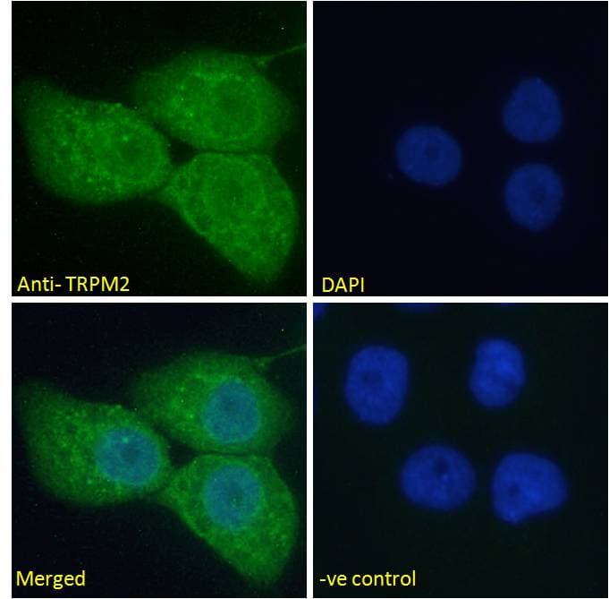 IHC-plus™ TRPM2 Antibody (aa1139-1150)