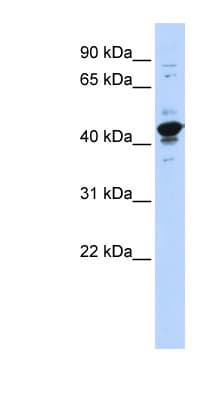 RBMXL2 Antibody (aa215-264)