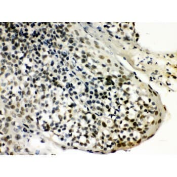 SNRPN Antibody (aa11-39)