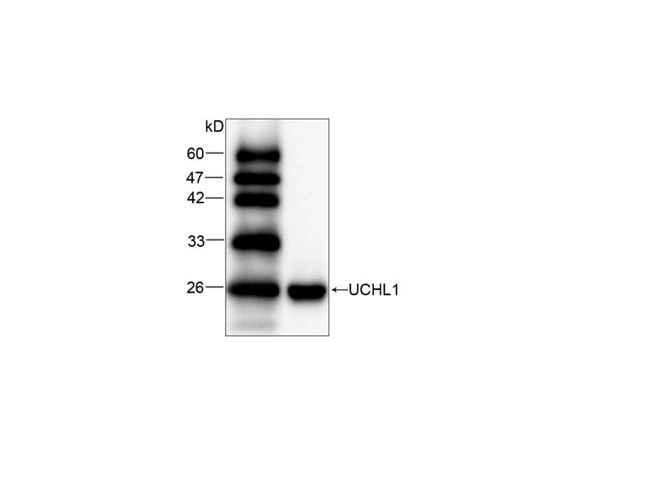 UCHL1 / PGP9.5 Antibody (clone 35)