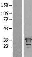 LGALS3 / Galectin 3 Protein (Over-Expression Lysate Myc-DDK (Flag))