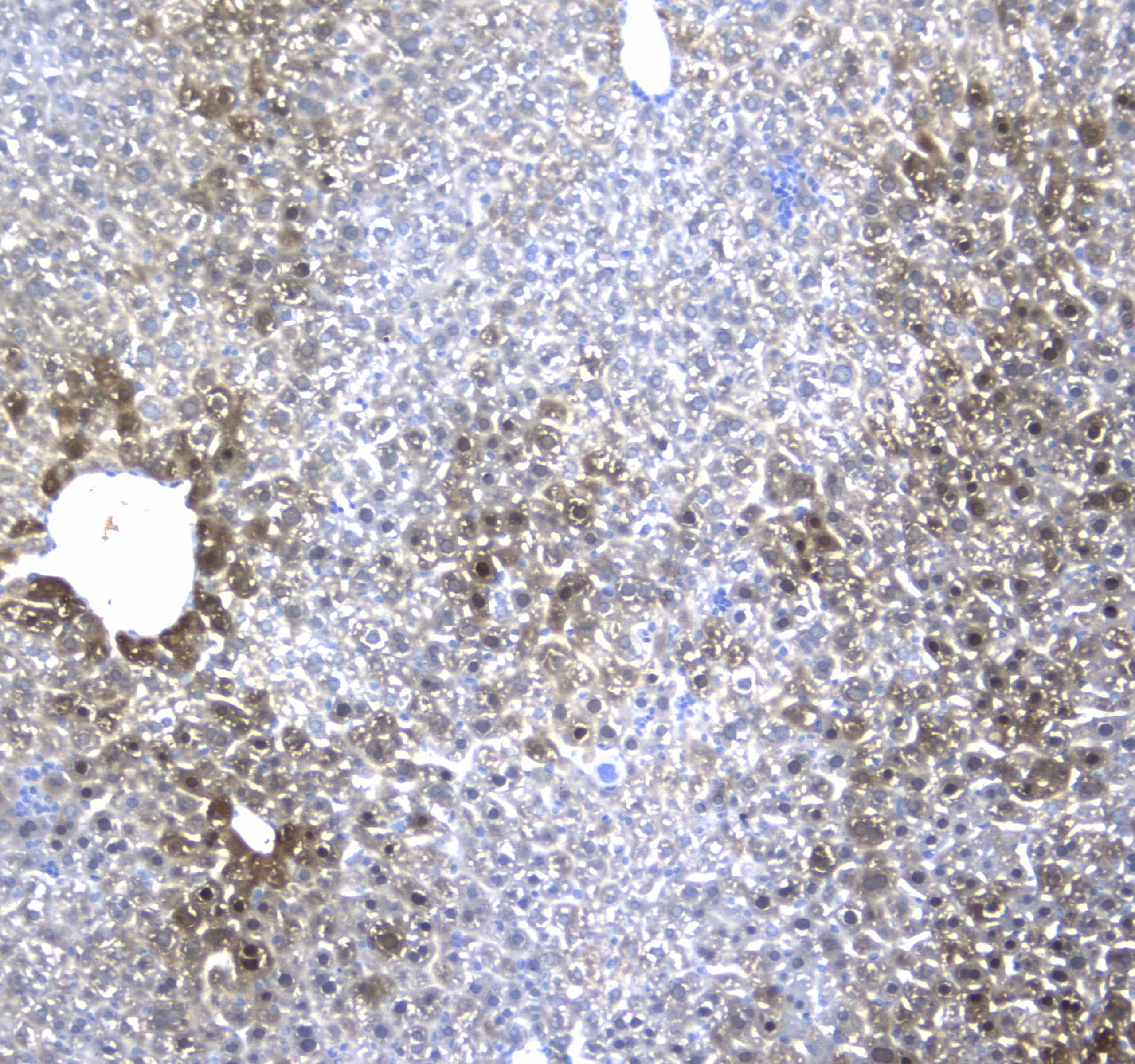 Polyclonal Rabbit anti-Human RGN / Regucalcin Antibody (IHC, WB)