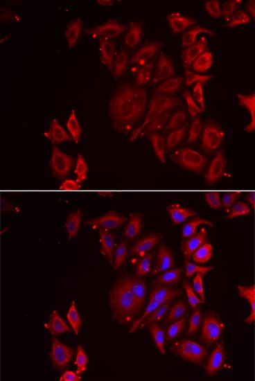 PAICS / ADE2 Antibody