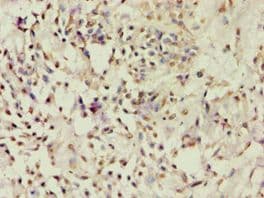 ACTRIIB / ACVR2B Antibody (aa19-140)